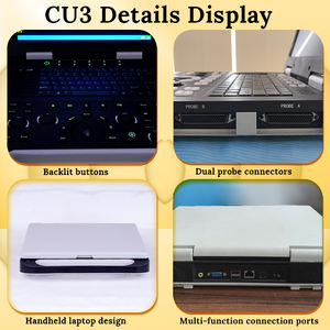 RS-CU5 haute résolution 3D couleur <span class=keywords><strong>Doppler</strong></span> 15 pouces noir Ecografo Portatil PW CW <span class=keywords><strong>Echo</strong></span> entièrement numérique gynécologie ultrasonique Ruisheng - Product Image 2