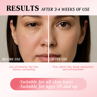 Fabricant de crème pour le visage en capsules OEM ODM Marque privée TXA Niacinamide Arbutin 70g Crème hydratante éclaircissante pour le visage