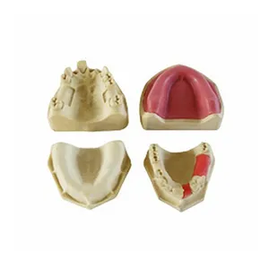 שיניים לסת תחתונה בפועל שתל שיניים דגם שתל ניתוח הדרכה דגם