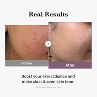 Tonique Lacté Éclat Anti-Âge au Glutathion medicube Age-R, Faible Irritation, Double Action pour un Teint Uniforme et un Éclat de Verre, Soin Coréen pour la Peau