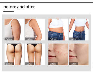 Masseur corporel de haute qualité, édition 2026, entièrement amélioré - Réduit efficacement la fatigue corporelle - Contrôle du temps - <span class=keywords><strong>Prix</strong></span> bas - Product Image 6