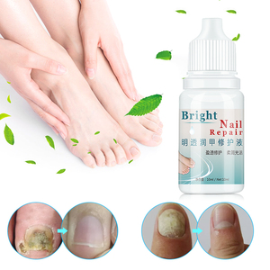 10ml onychomycose paronychie Anti-infection crème de traitement des ongles tue 99.9% bactéries champignon gel de soin des ongles fongiques - Product Image 5