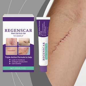 Crema para Eliminar Cicatrices, Hiperplasia, Quemaduras, Lesiones por Escaldaduras, Cicatrices Quirúrgicas, Estrías, Eliminador de Cicatrices y Marcas - Product Image 2