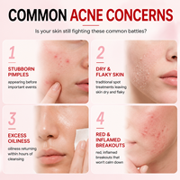 Lotion Séchante Nuit Rose Marque Blanche Traitement Anti-Acné Acide Salicylique Calamine Liquide Séchant Anti-Imperfections OEM