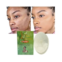 Savon éclaircissant pour l'acné et les taches noires de marque privée Traitement efficace de la pigmentation de la peau éclaircissant le teint uniforme