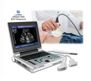 LANNX uRason N20 HD Medical écran couleur Scanner à ultrasons portable N/B système de diagnostic à ultrasons machine pour l'obstétrique