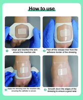 Pansement auto-adhésif personnalisé en film PU hypoallergénique pour canules IV, pansements pour plaies, patchs de fixation pour aiguilles intraveineuses