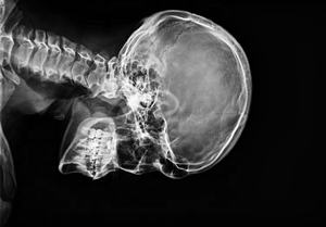 Détecteur à écran plat numérique DR FPD X-ray Imaging 14X17 - Product Image 3