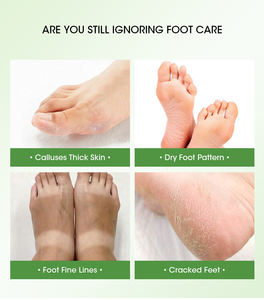 Efero — masque exfoliant au collagène pour les pieds, soin hydratant, élimine les <span class=keywords><strong>callosités</strong></span>, le mélanine, à l'aloe vera, exfoliant, élimine les <span class=keywords><strong>callosités</strong></span> - Product Image 2