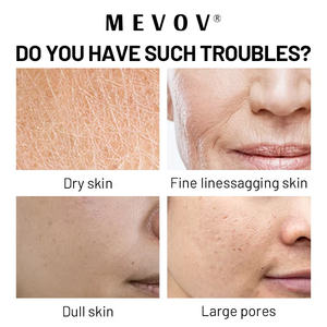 Huile de visage au <span class=keywords><strong>riz</strong></span> noir de marque privée avec extrait de <span class=keywords><strong>riz</strong></span> noir et vitamine C pour hydrater l'huile essentielle purifiante de peau - Product Image 4