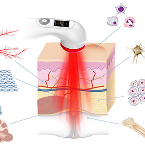 Handgehaltenes Rotlicht-Photobiomodulationsgerät für Allergische Dermatitis Niedrigenergie-Lasertherapie für Muskeln, Knie, Schulter, Rücken, Haustiere - Product Image 4