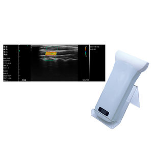 Pemindai Ultrasound nirkabel frekuensi tinggi <span class=keywords><strong>Probe</strong></span> <span class=keywords><strong>Linear</strong></span> lebar Super - Product Image 5