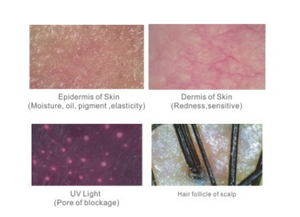 Máy Chẩn Đoán Tóc Wifi Không Dây 5G Máy Phân Tích Da Máy Dò Da Đầu Tóc Da Máy Phân Tích Da Và Tóc Có Màn Hình - Product Image 4