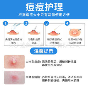 Apósito hidrocoloide médico Lianhui de 10 cm x 10 cm transparente para el rostro, parches para el acné de un solo uso - Product Image 4