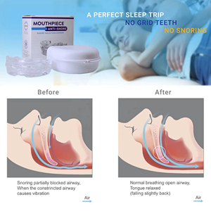 Pelindung mulut dapat diatur antimendengkur solusi mendengkur efektif untuk pria dan wanita dapat disesuaikan nyaman - Product Image 4