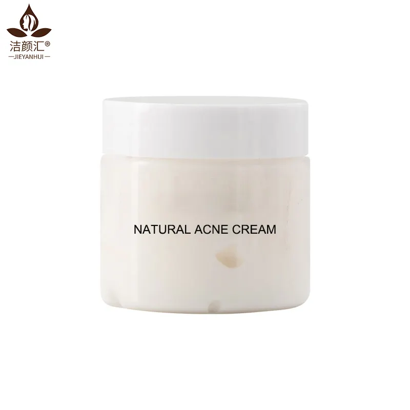 Crème anti-boutons d'acné, produit de soins pour la peau, élimination des cicatrices d'acné, vente en gros, 100 ml