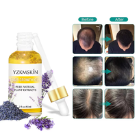 OEM ODM Huiles essentielles d'extraits naturels pour réparer et prévenir la perte de cheveux, traitement du cuir chevelu, massage hydratant, huile de croissance des cheveux à la lavande