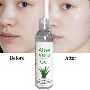 Private label all'ingrosso coreano sfuso naturale grezzo 100 puro lenitivo raffreddamento gel di aloe vera dopo il sole per la pelle del <span class=keywords><strong>viso</strong></span> in thailandia - Product Image 2