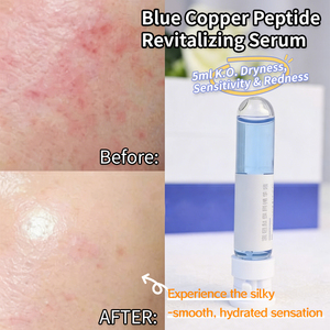 Suero de Péptidos de Cobre Azul GHK-Cu de Alta Calidad al por Mayor, Repara <span class=keywords><strong>la</strong></span> Barrera Cutánea, Reduce el Enrojecimiento, Cuidado de <span class=keywords><strong>la</strong></span> <span class=keywords><strong>Piel</strong></span> Sensible, Set de 16x5ml - Product Image 3