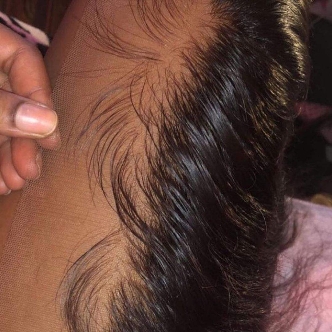 ส่วนหน้า &amp; ส่วนปิด