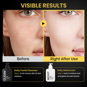 Ensemble de soins de la peau KOEC pour hommes, nettoyant visage et hydratant pour le visage 150g, vente en gros, crème hydratante pour le visage et nettoyant pour le visage pour tous les types de peau - Product Image 4