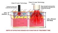 Appareil de thérapie laser de classe IV 30W 980nm 1064nm, équipement de physiothérapie laser pour les tissus profonds, clinique de la douleur, usage humain et vétérinaire