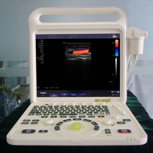 Équipement clinique, scanner d'échographie médical hospitalier, écran couleur numérique complet, appareil d'échographie Doppler couleur CU60 - Product Image 4