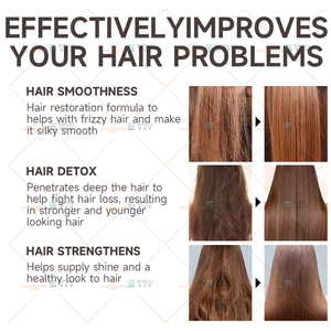 Fabricante de Cuidado Capilar Champú y Acondicionador Anticaspa Suavizante Reparador con Fragancia para Cabello Dañado - Product Image 6