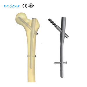 Conjunto de Instrumentos para Implante de Prego Intramedular Femoral PFNA Classe III - Kit Cirúrgico Ortopédico para Uso Hospitalar - Direto da Fábrica - Product Image 1