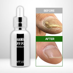 Sérum pour ongles Fussklar Deep Action pour réparer les ongles infestés de champignons et renforcer les ongles faibles, fins et abîmés pour une croissance saine - Product Image 1