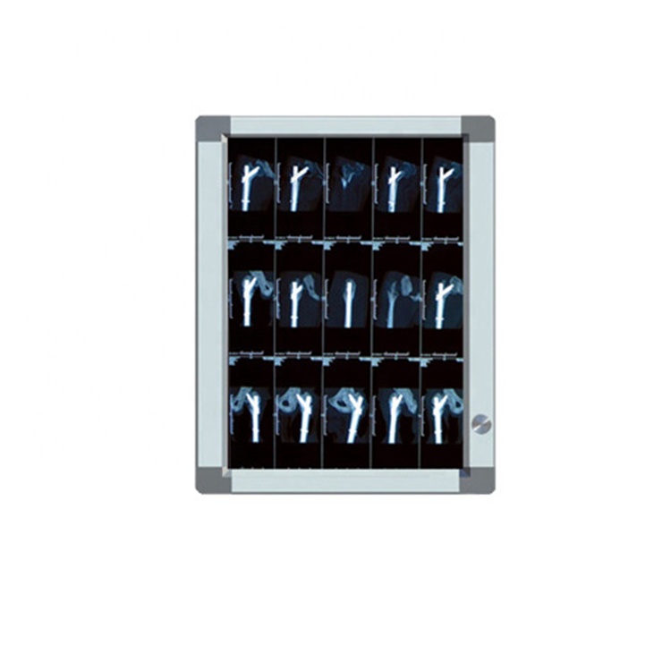 SINGLE PANEL 1PLA Medical LED X Ray Negatoscope