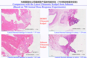 Instrumento Quirúrgico de Corte Preciso, Trauma Tisular Mínimo, Hemostático, Bisturí Veterinario Ultrasónico para Animales - Product Image 6