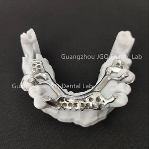 Marco dental de titanio de último diseño con <span class=keywords><strong>dentaduras</strong></span> acrílicas Precio perfecto asequible - Product Image 3