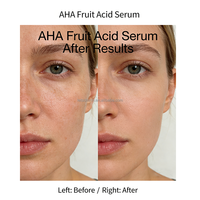 LS153 OEM/ODM AHA Fruitzuur Serum 30ml, Exfolieert & Verheldert de Huid, Olie Controle, Anti-rimpel, voor Private Label