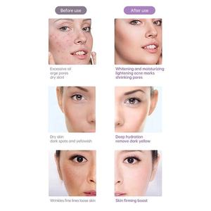 Dispositivo de Mesoterapia Portátil con Electroporación 2026, Multifuncional, sin Agujas, para Tratamientos de Belleza - Product Image 6