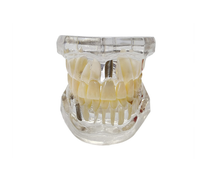 Modelo de Resina Desmontable para Implantes Dentales y Dientes Patológicos, Demostración de Cuidado Bucal y Puentes y Coronas de PVC para Ciencia Médica CE