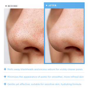 Oem Odm Cuidado DE LA Piel Ácido Hialurónico Hidratación Fórmula <span class=keywords><strong>no</strong></span> comedogénica Exfoliar Suavemente Limpieza Poros Espinilla <span class=keywords><strong>Aceite</strong></span> de Limpieza <span class=keywords><strong>Facial</strong></span> - Product Image 4