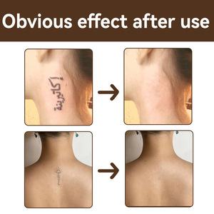 EELHOE kit de tatouage correcteur imperméable à l'eau clair foncé correcteur coton-tige scoop pour marque brûlure cicatrice tache <span class=keywords><strong>vitiligo</strong></span> chloasma - Product Image 5