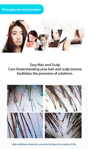 2026 Scalp Analyzer Hair Growth Anti Loss LED <b>Massage</b> Device Hair Vibration Scalp <b>Massage</b> Follicle Detection Skin <b>Massage</b> - Product Image 3