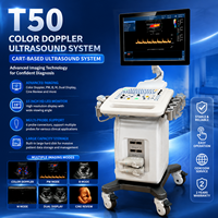 Máquina de Ultrasonido Doppler Color Digital para Uso Hospitalario con Alta Calidad de Imagen y Sistema de Almacenamiento de Datos de Gran Capacidad