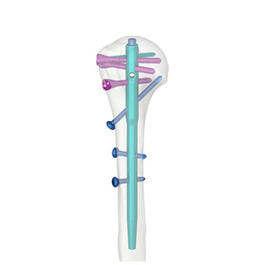 Clavo Intramedular de Titanio de Grado Médico con Certificación CE e ISO para Fijación Interna de Fracturas Proximales del Húmero - Product Image 1