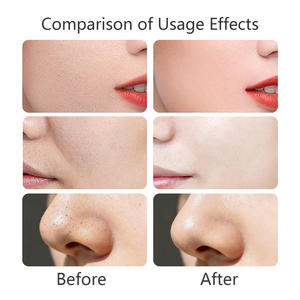 <span class=keywords><strong>Masque</strong></span> à l'argile bentonite et à l'arbre à thé, nettoyage en profondeur, contrôle du sébum, traitement de l'acné, purification des pores, apaisement des rougeurs, soin de la peau claire - Product Image 4