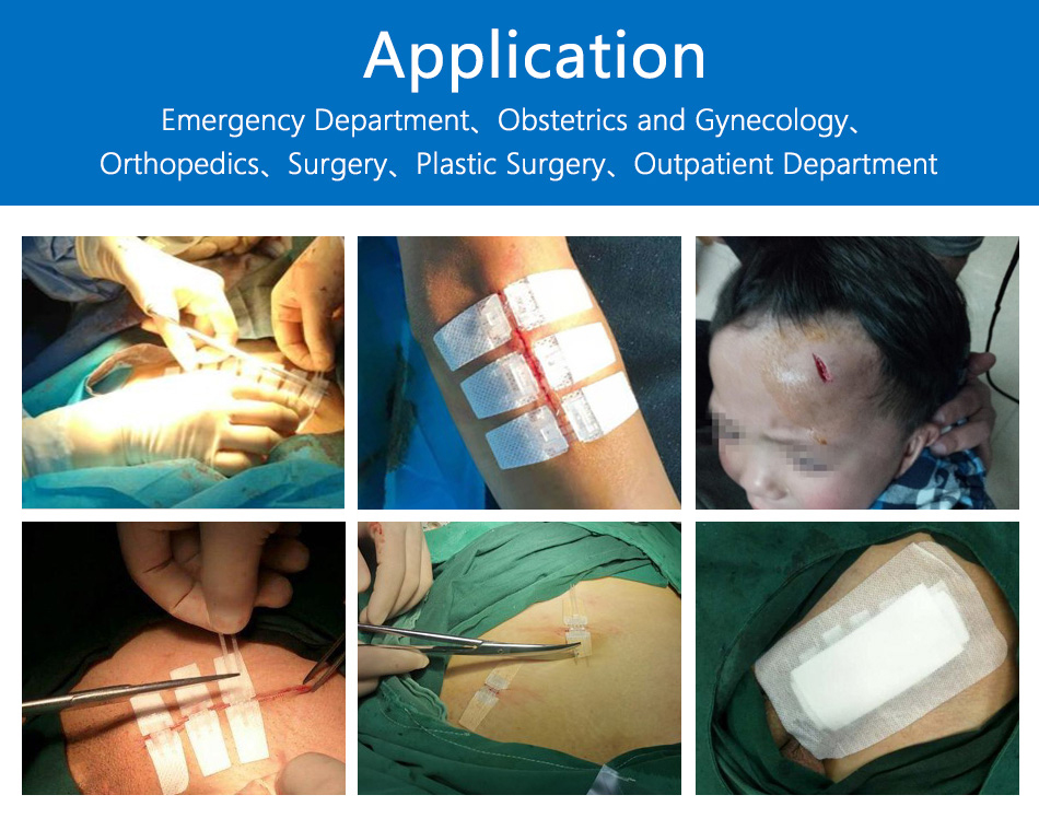 closure strips unistrut
