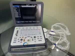 Mesin gema dokter manusia berkinerja tinggi dengan fokus dinamis waktu nyata & pengurangan kebisingan DopplerCU50 pencitraan Digital penuh - Product Image 4