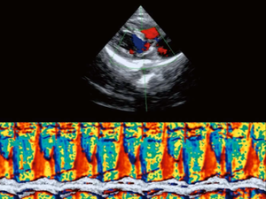 C59 Portable High-End <span class=keywords><strong>Echo</strong></span> untuk Kardiologi <span class=keywords><strong>2D</strong></span> 3D 4D Color <span class=keywords><strong>Doppler</strong></span> Veteriner & Manusia Portable Ultraosund untuk Pemeriksaan Jantung - Product Image 6