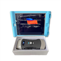 Ecógrafo Veterinario Portátil Doppler Color AI 3 en 1 con Sonda Inalámbrica PET - Precio