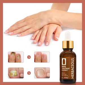 ELAIMEI Esencia para el Tratamiento de Uñas de 30 ml, Antifúngica, Acelera el Metabolismo de las Uñas, Nutre las Uñas de los Pies, Suero Reparador de Uñas - Product Image 6