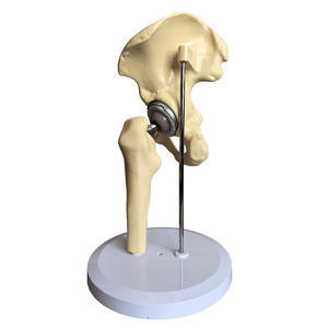 Медицинская наука, модель замены тазобедренного сустава для предхирургической коммуникации, искусственная модель тазобедренного сустава - Product Image 6