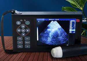 Sistem Pemindai Ultrasonografi Putih Hitam Mesin Ultrasonografi Array Konveks Pemindai Ultrasonografi Diagnostik Portabel Kehamilan Hewan - Product Image 4