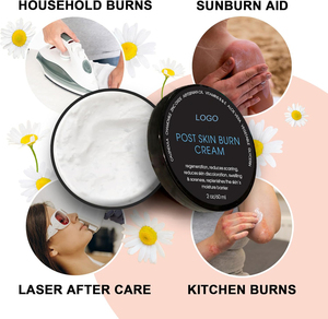 Etiqueta privada Post Skin Burn Cream Sunburn Cream <span class=keywords><strong>para</strong></span> el tratamiento de primeros auxilios Hidrata repara la piel con <span class=keywords><strong>heridas</strong></span> de manteca de karité de <span class=keywords><strong>Aloe</strong></span> Vera - Product Image 4